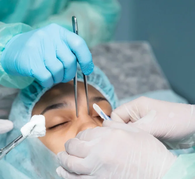 قسم الجراحة التجميلية